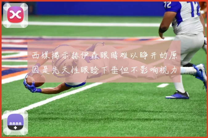 西媒揭示赫伊森眼睛难以睁开的原因是先天性眼睑下垂但不影响视力